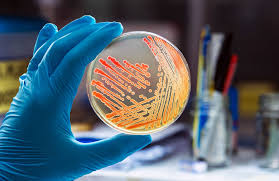 Legionella testing team in London